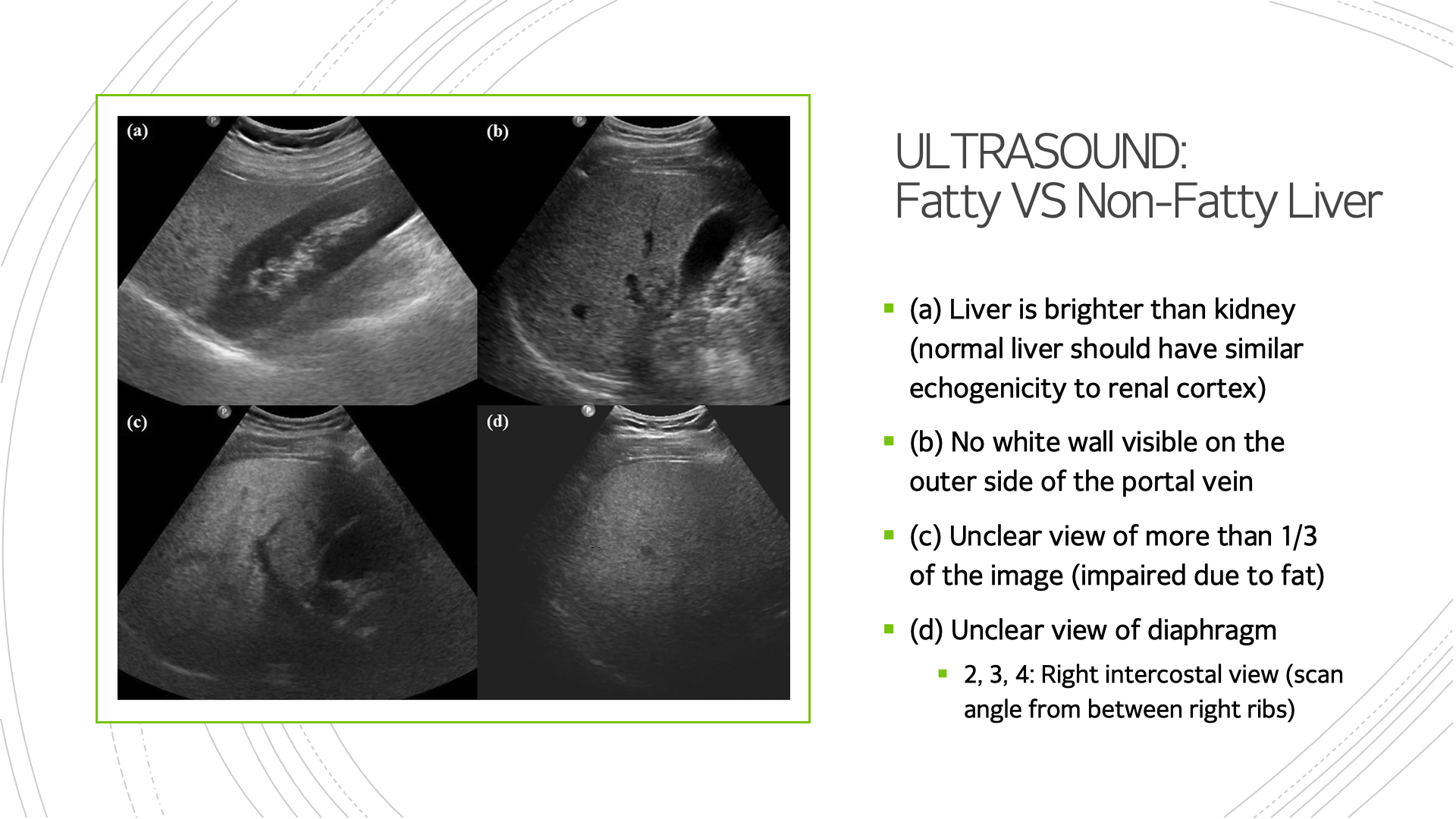 Fatty Liver Determination Using CNN Deep Learning Model — slide 3