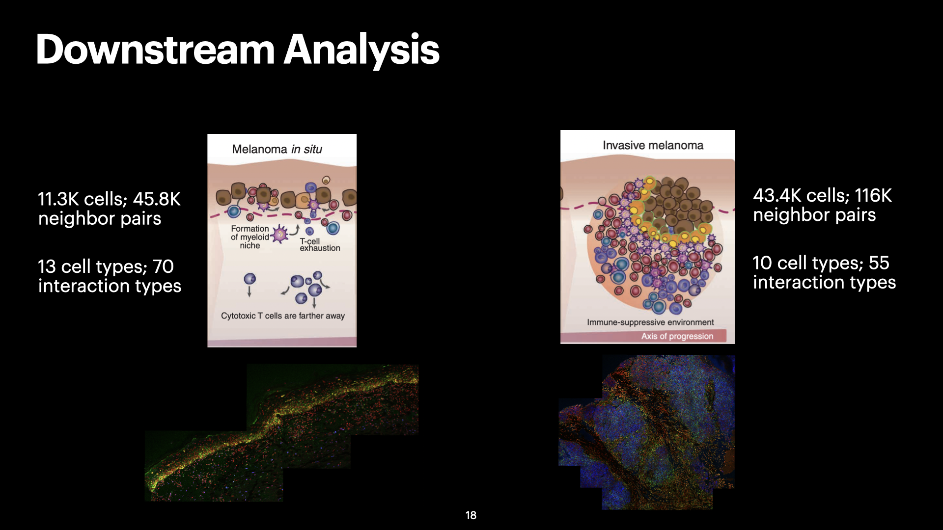 3D Spatial Analysis of Cell-Cell Interactions in Tumor-Immune Microenvironments — slide 18